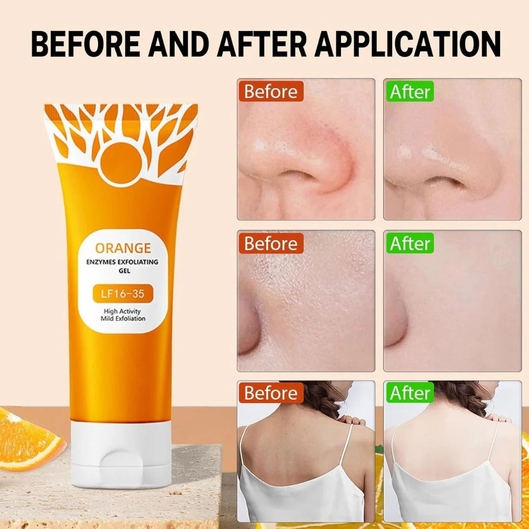 Orange Enzyme Exfoliating Gel — The Gentle Miracle Your Skin Has Been Crying Out For”